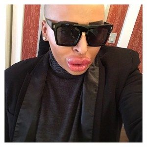 kim2