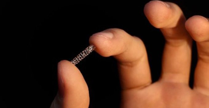 stents périmés