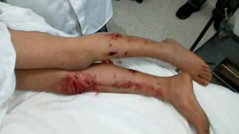 jambe
