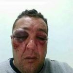 Photo de Ferjani, l'homme qui aurait été agressé par le chef de la police du Kram Est.